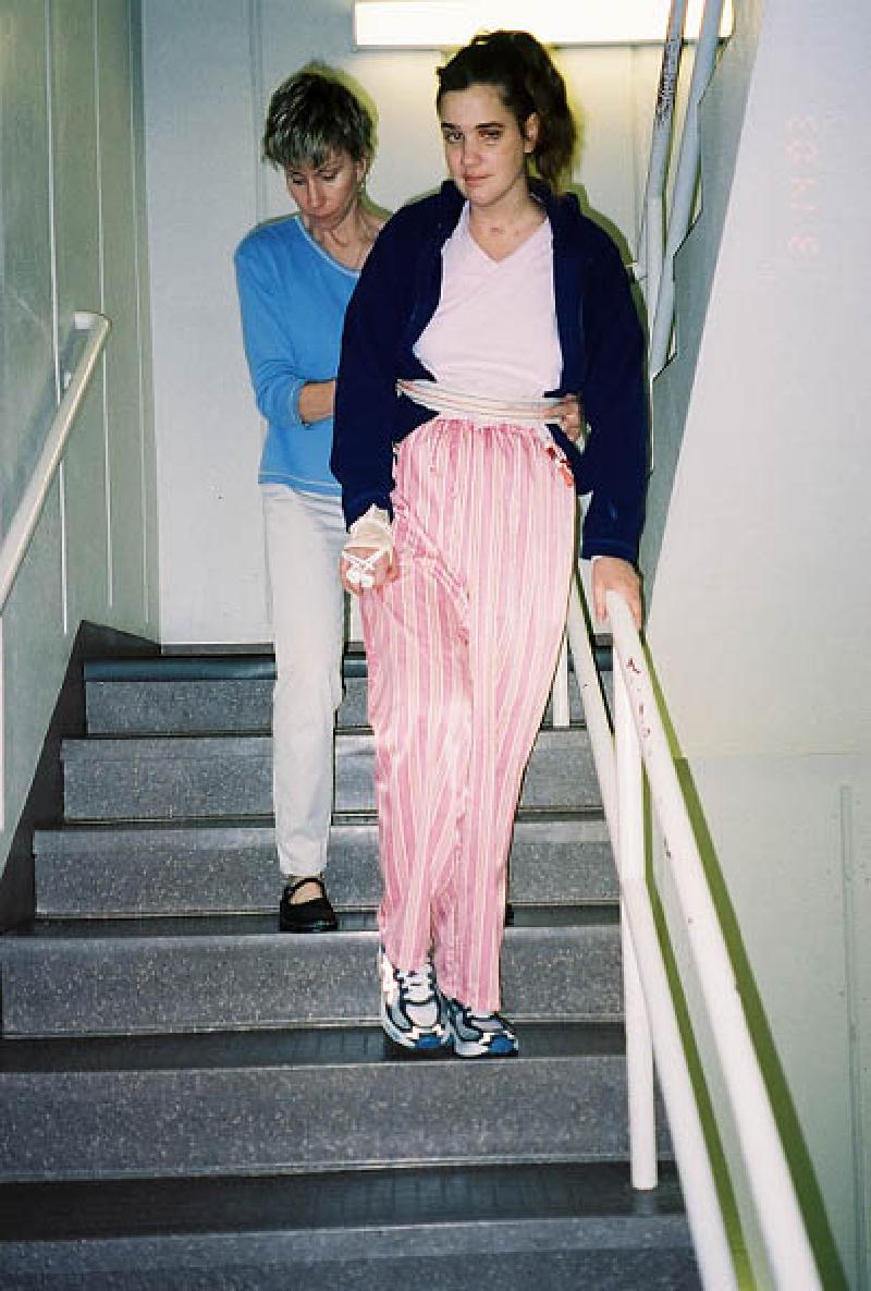 Marla getting some practice walking on the stairs. Very hard work, and very tiring for her!