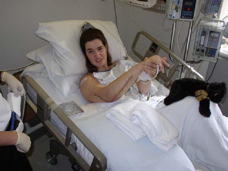 Marla reviews her surgical incision during a dressing change. The incision was closed with staples.